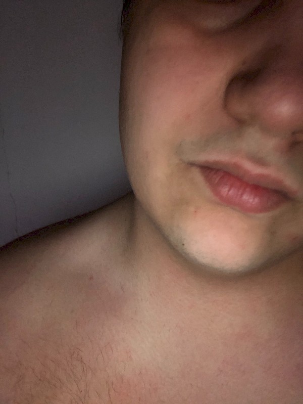 avatar-ObeseDominant